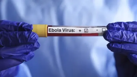 Africa CDC Genel Direktörü, Ebola aşısının geliştirilmesinde Afrika'nın ihmal edildiğini söyledi